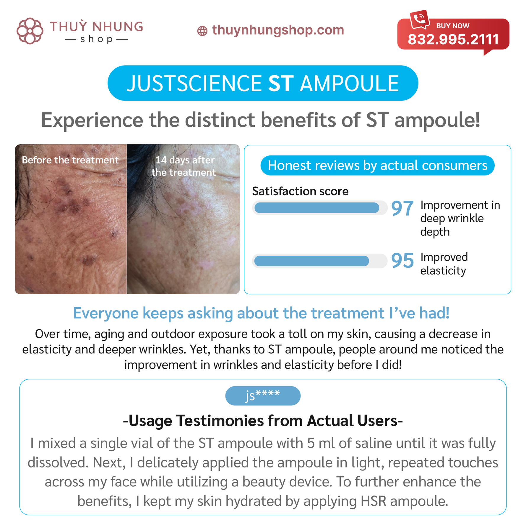 [ Bio FD&C]   ST AMPOULE FOR WRINKLE & STRETCH MARK TREATMENT - Nanagin